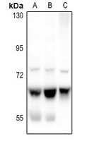 Anti-ME1 Antibody