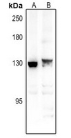 Spinophilin antibody