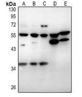 CD215 antibody