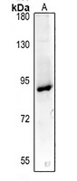Anti-Podocan Antibody