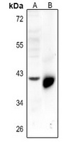 Anti-5-HT4 Antibody