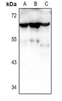 Anti-CRHR2 Antibody