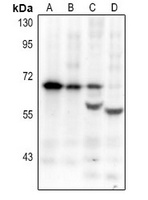 Anti-Endothelin A Receptor Antibody