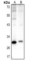 Carbonic Anhydrase 1 antibody
