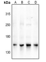 Anti-NCOA3 Antibody