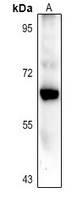 Anti-CARM1 Antibody