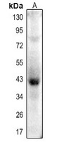 Anti-Actin-pan (Acetyl-K52/50/51) Antibody