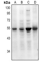 Anti-SMAD7 (Acetyl-K70) Antibody