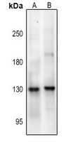 Anti-NMDAR1 (Phospho-S890) Antibody