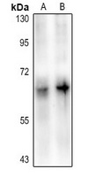 Anti-DAB1 (Phospho-Y220) Antibody