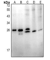 ABHD14B antibody