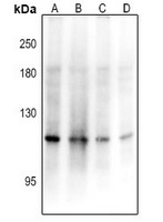 ADAMTS17 antibody