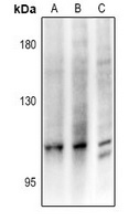 Anti-CCP3 Antibody