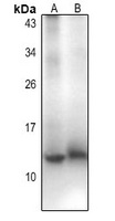 CCL18 antibody