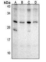 Anti-NKX2-8 Antibody