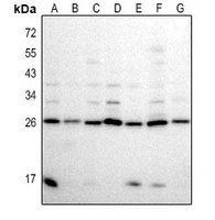 BCL7A antibody