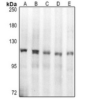 Anti-Topoisomerase 1 Antibody