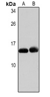 Anti-CCL2 Antibody