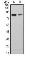 Anti-AKAP4 Antibody