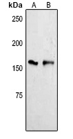 Anti-YTHDC2 Antibody