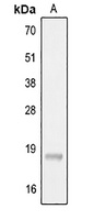 Anti-IL-22 Antibody