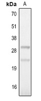 Anti-IL-25 Antibody