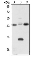 YKL-39 antibody