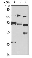 Anti-RBM14 Antibody