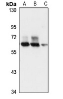 Anti-ACF Antibody