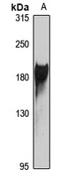 Anti-ABCA3 Antibody