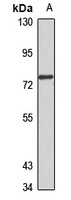 Anti-ABCG8 Antibody