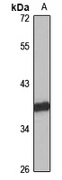 Anti-ABHD5 Antibody
