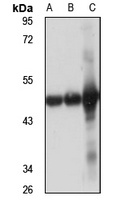 Anti-ACAA2 Antibody