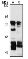 ACOX2 antibody