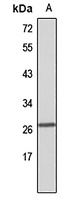 ACRV1 antibody