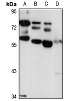 ACSF3 antibody