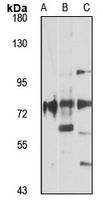 Anti-ACSL1 Antibody