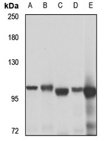 Anti-ACTL8 Antibody
