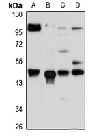 Anti-ACTR6 Antibody