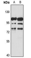 Anti-ADAM11 Antibody