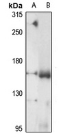 Anti-ADAMTS13 Antibody