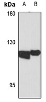 Anti-ADAMTS2 Antibody