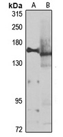 Adenylate Cyclase 2 antibody