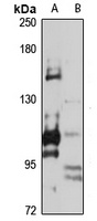 Adenylate Cyclase 3 antibody