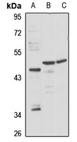 AdipoR2 antibody