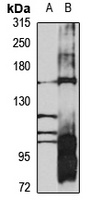 Anti-AGL Antibody