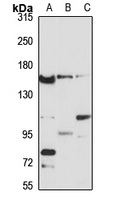 AGTPBP1 antibody