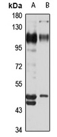 Anti-CD166 Antibody