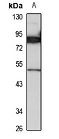 Anti-ALDH1A3 Antibody