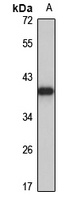 ALG5 antibody